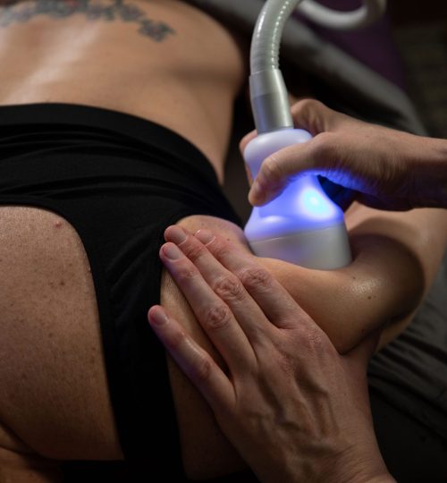 200207-cryoskin-7814-scaled